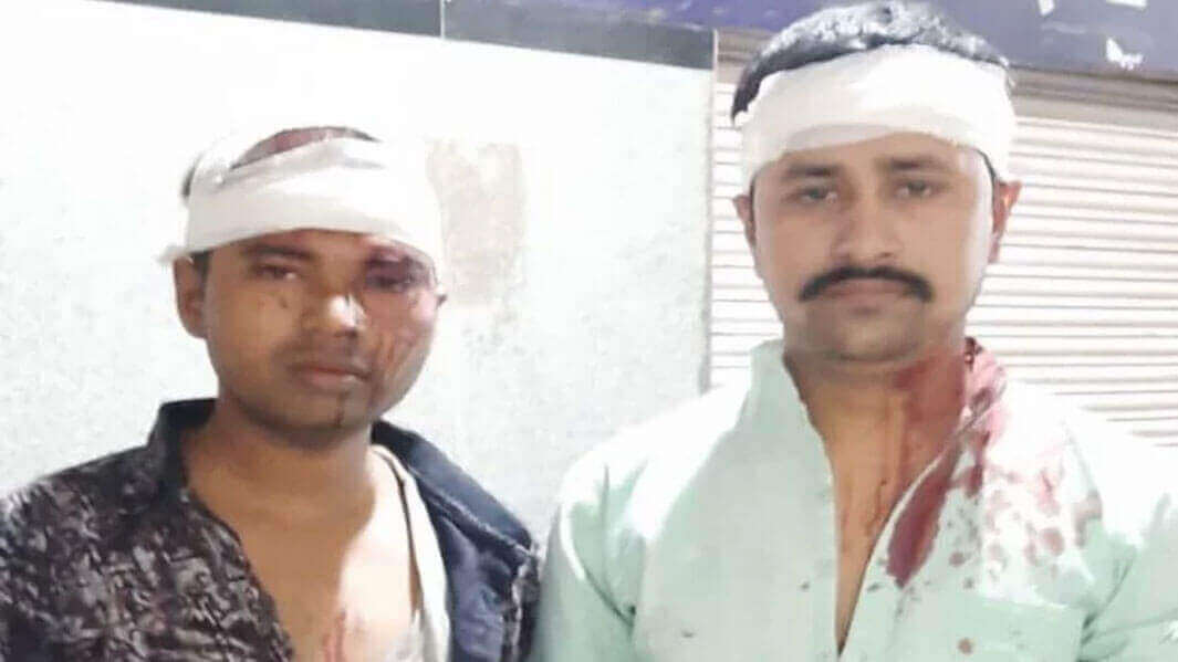 Varanasi में बदमाशों ने कवियों के साथ की लूटपाट, दो को पीट कर किया जख़्मी